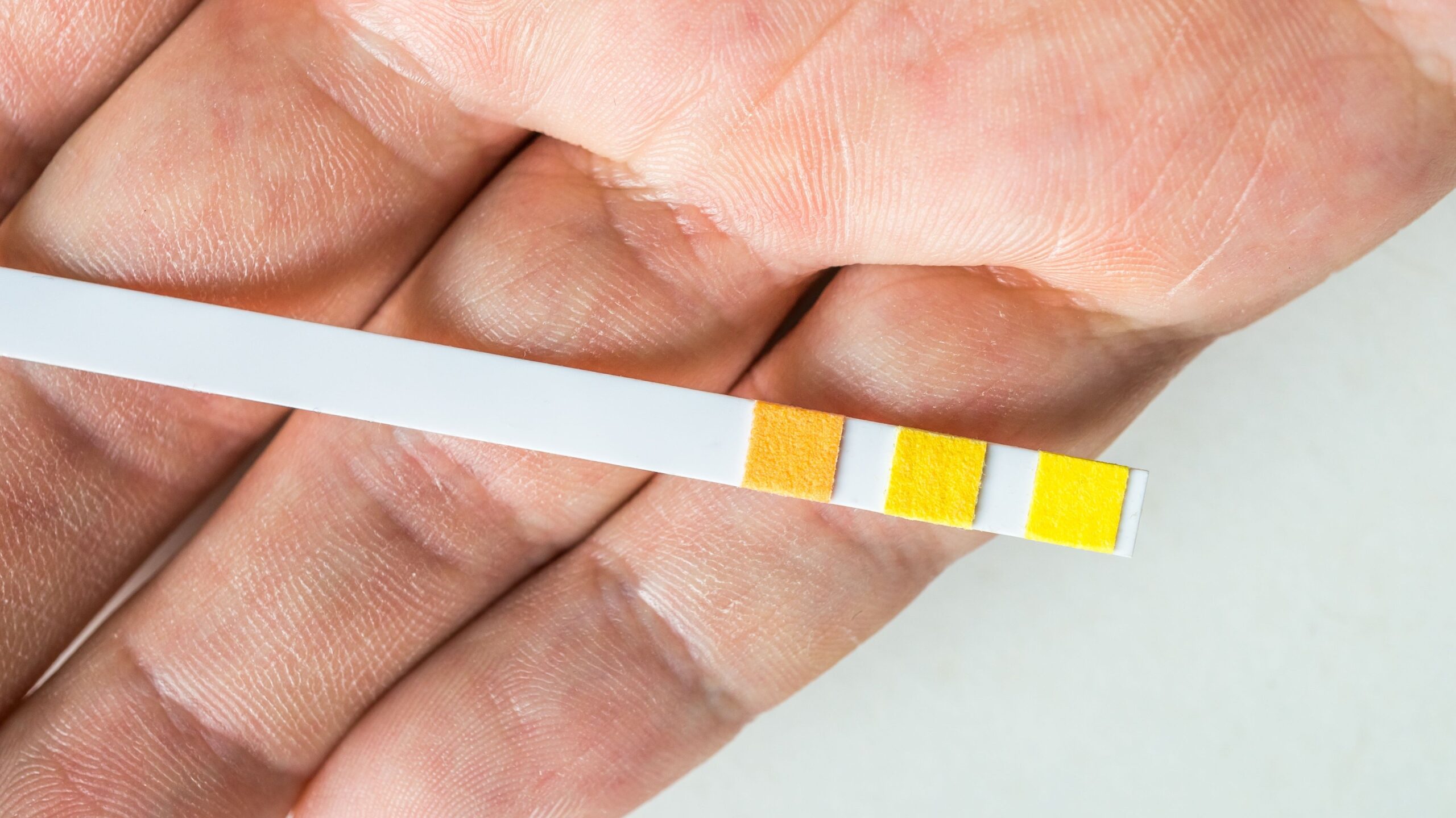 Infektionsläkarna avfärdar urinstickor i nytt vårdprogram